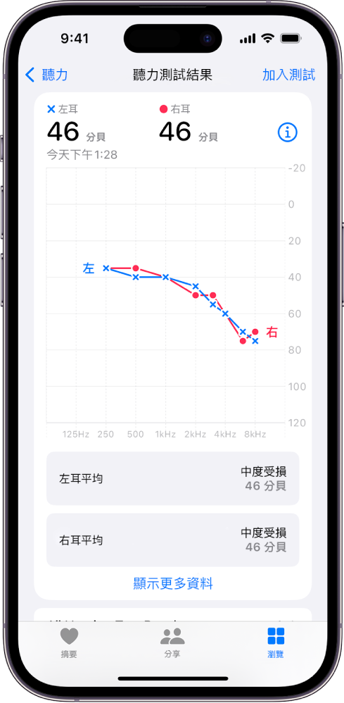 iPhone 上的聽力圖,顯示兩耳均為中度聽力受損。